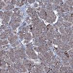 MRPS35 Antibody in Immunohistochemistry (IHC)