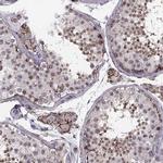 WDR63 Antibody in Immunohistochemistry (IHC)