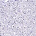 A2ML1 Antibody in Immunohistochemistry (IHC)