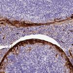 A2ML1 Antibody in Immunohistochemistry (IHC)