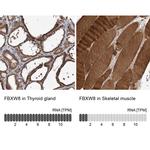 FBXW8 Antibody in Immunohistochemistry (IHC)