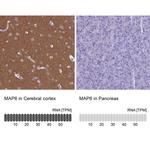 MAP6 Antibody in Immunohistochemistry (IHC)