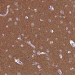 MAP6 Antibody in Immunohistochemistry (IHC)