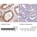 HSPA4L Antibody in Immunohistochemistry (IHC)