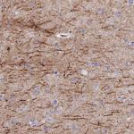 C10orf4 Antibody in Immunohistochemistry (IHC)