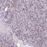 BANF1 Antibody in Immunohistochemistry (IHC)