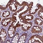 NAA16 Antibody in Immunohistochemistry (IHC)