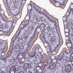 SELT Antibody in Immunohistochemistry (IHC)