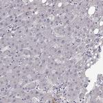 B3GNT6 Antibody in Immunohistochemistry (IHC)