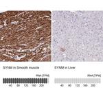 SYNM Antibody in Immunohistochemistry (IHC)