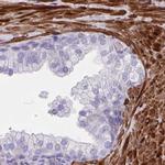 SYNM Antibody in Immunohistochemistry (IHC)