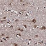 CSTF3 Antibody in Immunohistochemistry (IHC)