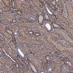 USPL1 Antibody in Immunohistochemistry (IHC)