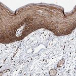 ADAMTS10 Antibody in Immunohistochemistry (IHC)