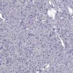 CREB3L3 Antibody in Immunohistochemistry (IHC)