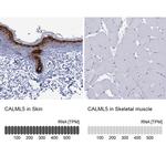 CALML5 Antibody in Immunohistochemistry (IHC)