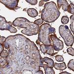 STRA6 Antibody in Immunohistochemistry (IHC)