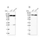 alanyl-tRNA Synthetase Antibody in Western Blot (WB)