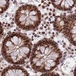 POLR2C Antibody in Immunohistochemistry (IHC)