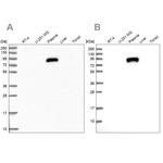 ALS Antibody in Western Blot (WB)