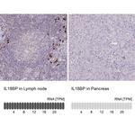 IL18BP Antibody in Immunohistochemistry (IHC)