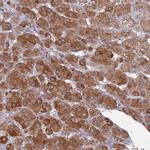 KCTD14 Antibody in Immunohistochemistry (IHC)