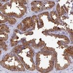 KCTD14 Antibody in Immunohistochemistry (IHC)