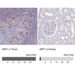 ZBP1 Antibody in Immunohistochemistry (IHC)