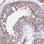 GAS8 Antibody in Immunohistochemistry (IHC)