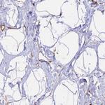 GAS8 Antibody in Immunohistochemistry (IHC)