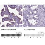 NEK5 Antibody in Immunohistochemistry (IHC)