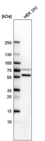 SETD6 Antibody in Western Blot (WB)