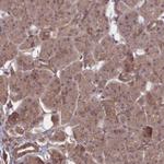 FAM96B Antibody in Immunohistochemistry (IHC)