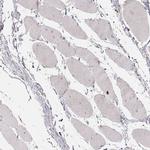 ABCA7 Antibody in Immunohistochemistry (IHC)