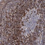 DGKA Antibody in Immunohistochemistry (IHC)