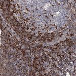 DGKA Antibody in Immunohistochemistry (IHC)