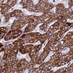 UQCRFS1 Antibody in Immunohistochemistry (IHC)