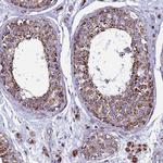 UQCRFS1 Antibody in Immunohistochemistry (IHC)