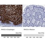 RHCG Antibody in Immunohistochemistry (IHC)