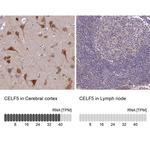 BRUNOL5 Antibody in Immunohistochemistry (IHC)