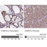 CHMP2A Antibody in Immunohistochemistry (IHC)
