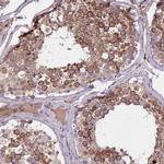 F1A alpha Antibody in Immunohistochemistry (IHC)