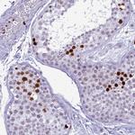 Histone H4 Antibody in Immunohistochemistry (IHC)