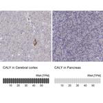 CALY Antibody in Immunohistochemistry (IHC)