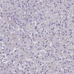 SUR1 Antibody in Immunohistochemistry (IHC)