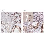 AKAP8L Antibody in Immunohistochemistry (IHC)