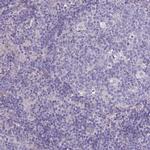 SPHKAP Antibody in Immunohistochemistry (IHC)