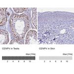 CENPV Antibody