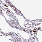 ARHGEF18 Antibody in Immunohistochemistry (IHC)