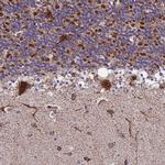 MRPS18B Antibody in Immunohistochemistry (IHC)